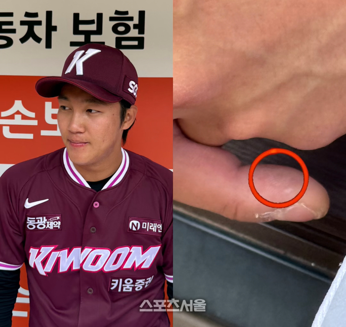 안우진 손 왜 이래? 알고 보니...오른 중지 '굳은살'이 나타낸 에이스의 '굳은 의지'