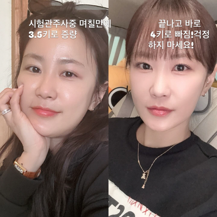 '김준호♥' 김지민, 시험관 부작용 어떡하나..."붓기 심하다"