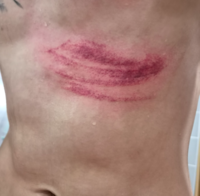 [속보] ‘갈비뼈 골절의심’ FC서울 최준, 다행히 타박상 진단…“다만 며칠 더 관찰 필요”