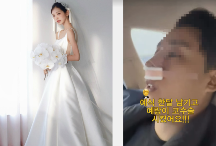 최준희, 결혼 앞두고 예비신랑 코수술 공개..."사랑하면 닮는 걸로"