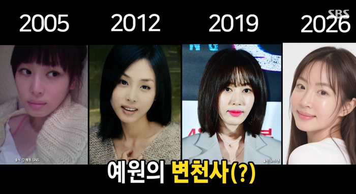 “10번은 넘지 않아”…강예원, 눈 성형 횟수 고백에 母 “속상하다”