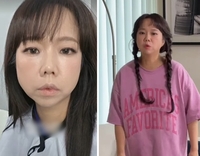 “위고비 아니라더니”...홍현희, 얼굴 반쪽 된 근황에 팬들 ‘걱정’