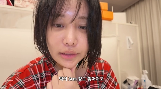 랄랄, 2살 딸 사고 당시 상황 설명 “턱 3cm 찢어지고 아랫니 두 개 빠져”