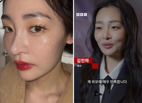 “건강 이상설 우려” 김민하, 17kg 빼고 BBC서 뜻밖의 고백 “내 얼굴 좋아”