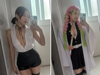 “욕먹어도 괜찮아?” 이세영, 성형 부작용 고백 후 또 노출 ‘시끌’