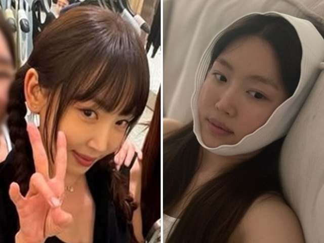 “앞트임 망해” 강예원, 복원 성형 후 아이돌 비주얼...47세 맞아?