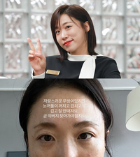 “곧 의버지 찾아갈지도”…배우 이미도, 무쌍 눈꺼풀 고충 토로