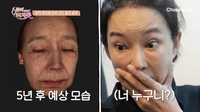 ‘종말이’ 지우려다 얼굴까지 잃었다…‘급노화’ 곽진영, 성형 부작용의 끝은?