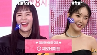 장영란, ‘성형미인 논란’ 직접 해명…‘40대→20대 변신’ 비결은 전현무 소개로 ‘이것’
