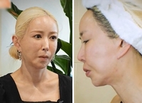 “내 얼굴 왜 이래?” 슈, ‘성형 의혹’ 있었는데…확 처진 피부에 팬들 ‘충격’