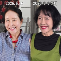 1년 사이 충격변신…윤영미, 안면거상·모발이식후 자신감 ‘미스코리아 출전?’