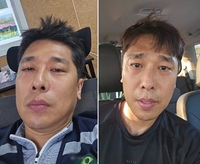 “막노동이 어때서?” 김동성, 흰머리 희끗…생활고 속 근황에 네티즌 ‘갑론을박’