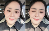 문근영, 급성구획증후군 털고 되찾은 방부제 동안 미모