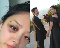 파혼에 폭행 의혹까지…유현철♥김슬기, 결혼식 소식에 축하 대신 ‘악플’ 눈살