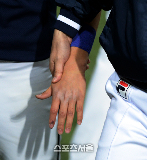 [SS포토] 한국시리즈 정수빈, 박근홍의 공에 시퍼렇게 멍든 왼손!