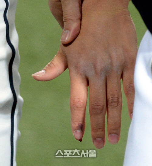 [SS포토] 한국시리즈 정수빈, 손끝에 맺힌 핏방울...2차전엔...?