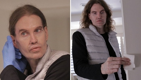 [B급통신] 결벽증 때문에 끊임없이 성형하는 남성