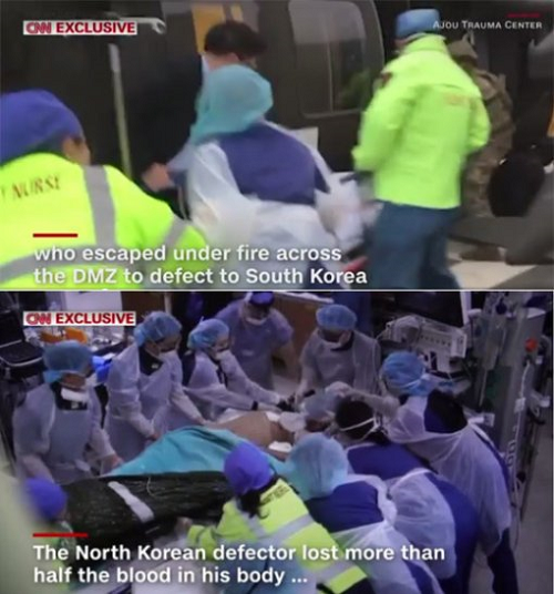 '총알 자국·기생충'…CNN, 이국종 교수 北 귀순병 수술 영상 독점 공개