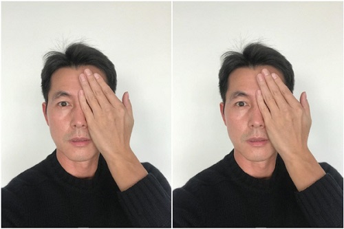 "시리아 아이들을 위해"…정우성이 한쪽 눈을 가린 이유