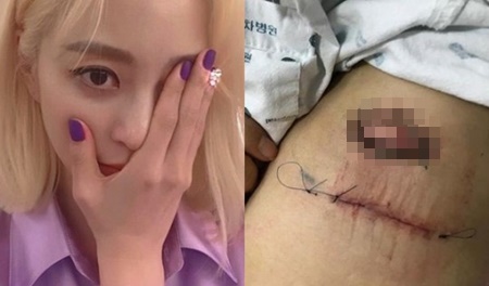 [SS이슈] 한예슬 "어떤 보상도 위로 안 돼" VS 차병원 "보상 논의 중" 