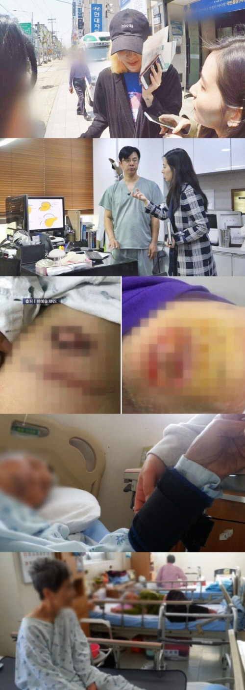 '소비자 탐사대', 한예슬 의료사고 전격 인터뷰 공개