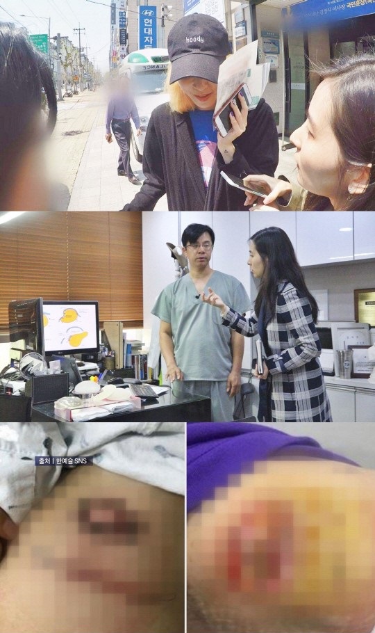 'CSI: 소비자탐사대', 한예슬 인터뷰 공개…의료사고 심경 전한다