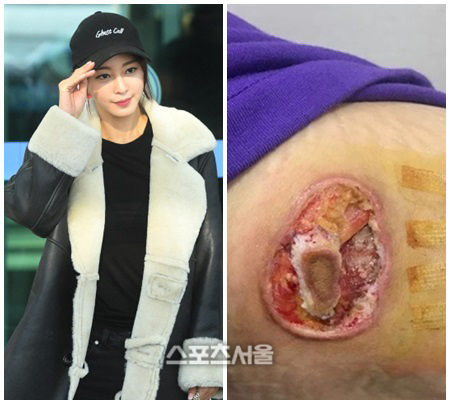 '뉴스룸', 한예슬 의료 사고 그 후…차병원 측 일반인 차별 논란