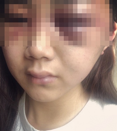 광주 데이트폭력 피해자 "전남친은 괴물…하루하루가 지옥이다"