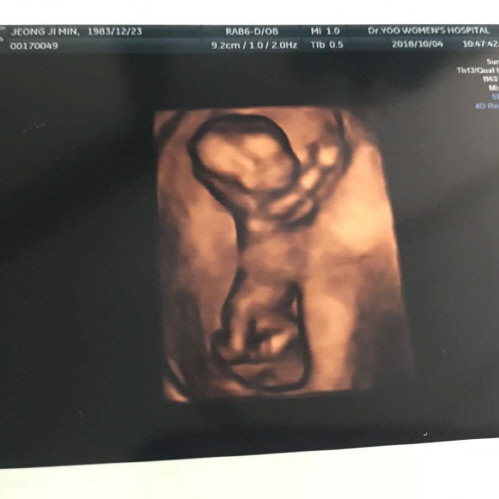 개그우먼 정지민♥가수 공휘 둘째 임신.."성별은 몰라요~"