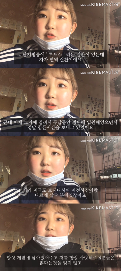 故 최진실 딸 최준희가 걸린 '루푸스병', 원인과 증상은?