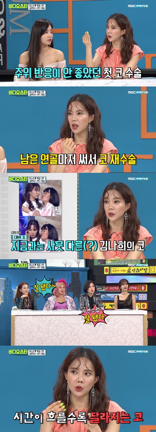 '비디오스타' 김나희, 쿨한 고백 "코 성형 2번 했다...변형 오기도"