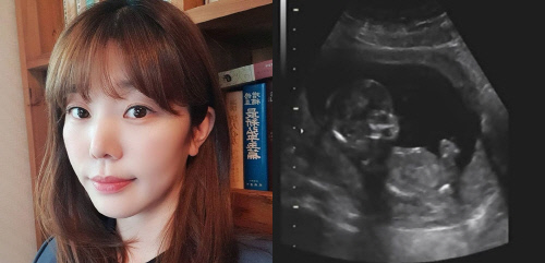 '응팔' 이문정 "결혼 1년 만에 임신...사랑 주는 엄마 될게요"[전문]