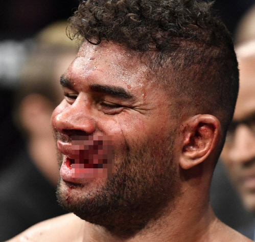 '입술이 사라진' 오브레임, 'UFN 워싱턴'서 로젠스트루이크의 주먹에 4초 남기고 KO패