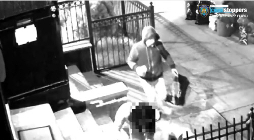 '동양인 혐오 범죄' 기승, 美 남성→30대 동양인 여성 '염산 테러'