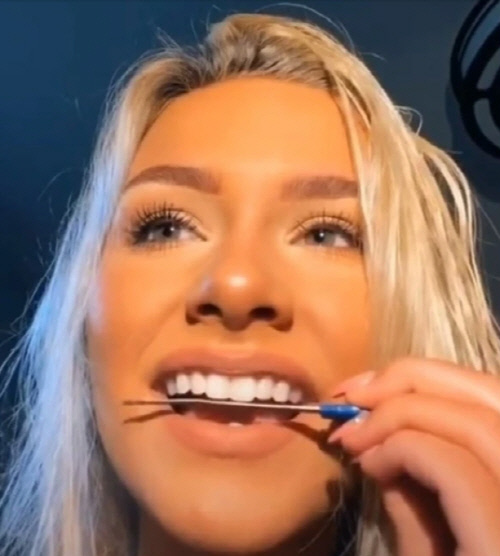 英 10대 사이에서 SNS로 유행 중인 잘못된 치아 성형, 미백 방법 [B급통신]