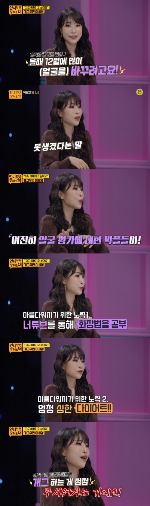 외모 비하 악플에 성형 결심한 개그맨 이세영 "화나서 12월 수술 예약했다"