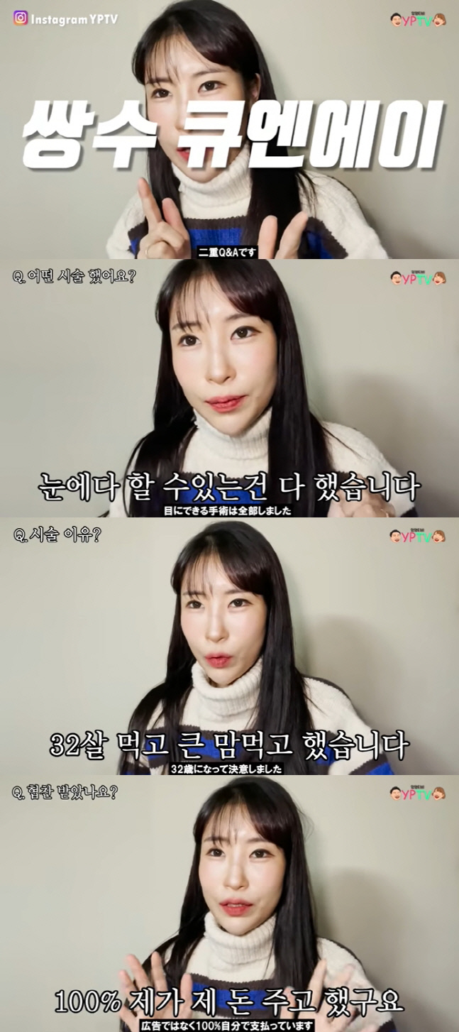 이세영의 쌍커풀 수술 후기 "콤플렉스 극복…협찬 아닌 100% 내 돈 주고 했다"