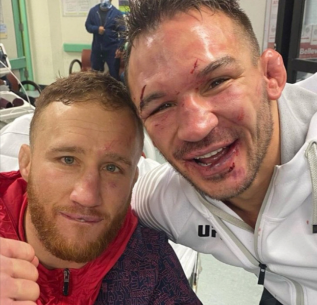 ‘Fight of the Year’ 격찬 ‘개이치 vs 챈들러’ 戰, 깊은 상처로 기자회견장이 아닌 병원으로 직행!