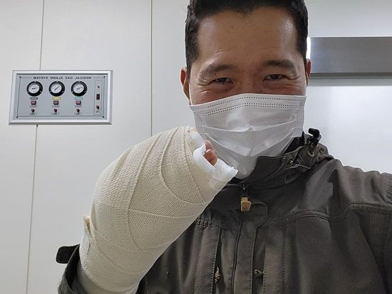 '개통령' 강형욱, 아찔한 개물림 사고로 응급실행... 오른손 뼈드러나 붕대 칭칭