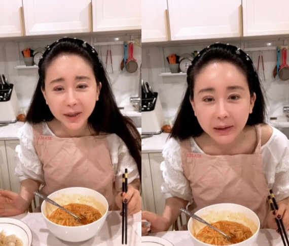 함소원, 쌍꺼풀 재수술에 눈 퉁퉁 "이왕 하는 거 더 크게"