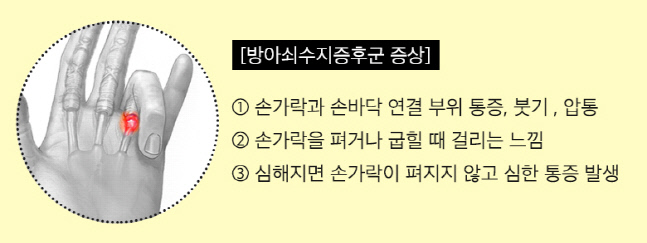 방아쇠수지-증상