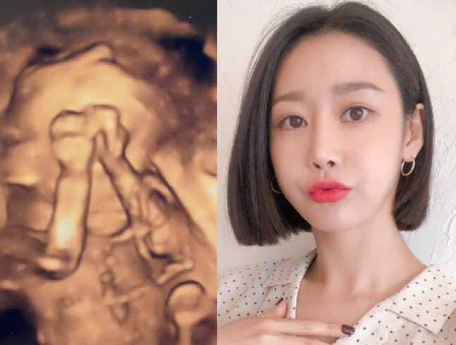 "출산 100일전" 크레용팝 출신 배우 송보람, 두 아이 엄마 된다