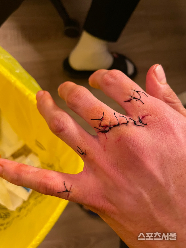 11바늘 꿰맨 박장혁