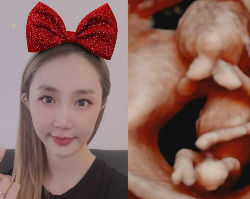 천상지희 출신 선데이, 유산 끝 임신 경사 "9월 만나"