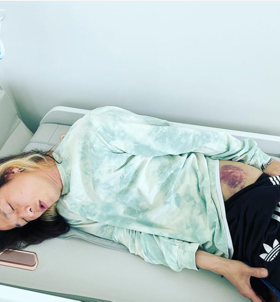 팝핀현준, 오토바이 사고당해 "골반사망"