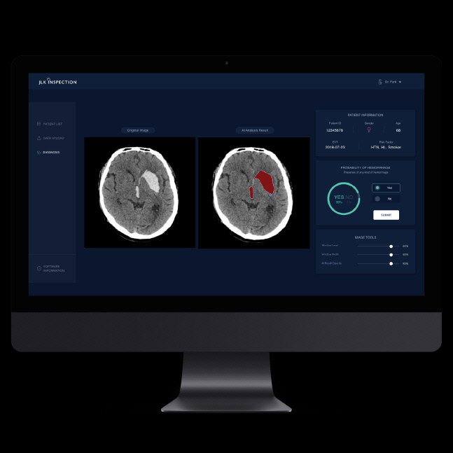 1)제이엘케이 뇌출혈 솔루션 JBS-04K