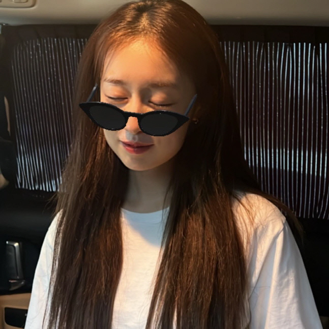 지연, ♥황재균 사랑받더니 겁 없어졌나…사랑니 2개 뽑고 다람쥐 됐네[★SNS]