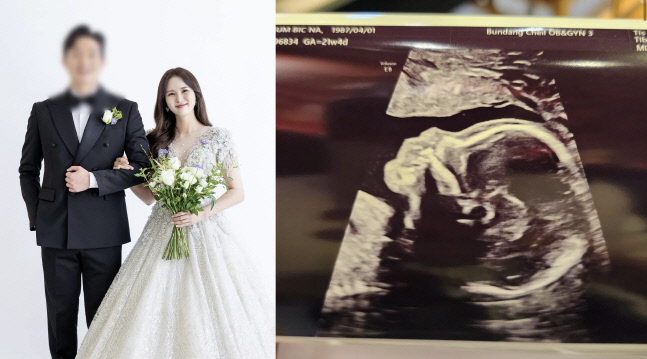 써니힐 빛나, 결혼 1년 만에 임신 "건강하게 잘 키우겠다"[★SNS]