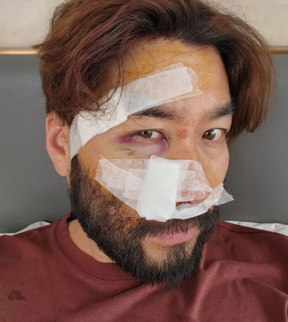 노