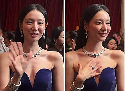 김지원 맞나?...확 달라진 체형변화, 안쓰러울 정도